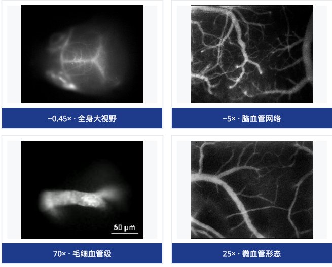 宽场系统四种放大倍率下的实拍成像：从全身大视野到毛细血管级分辨